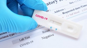 С 30 мая ПЦР-тесты на COVID-19 нельзя будет провести в негосударственных медцентрах