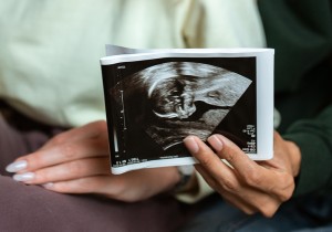 В Беларуси предлагают беременных официально освобождать от работы для прохождения обследований